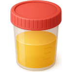 ¿Qué análisis usa orina?